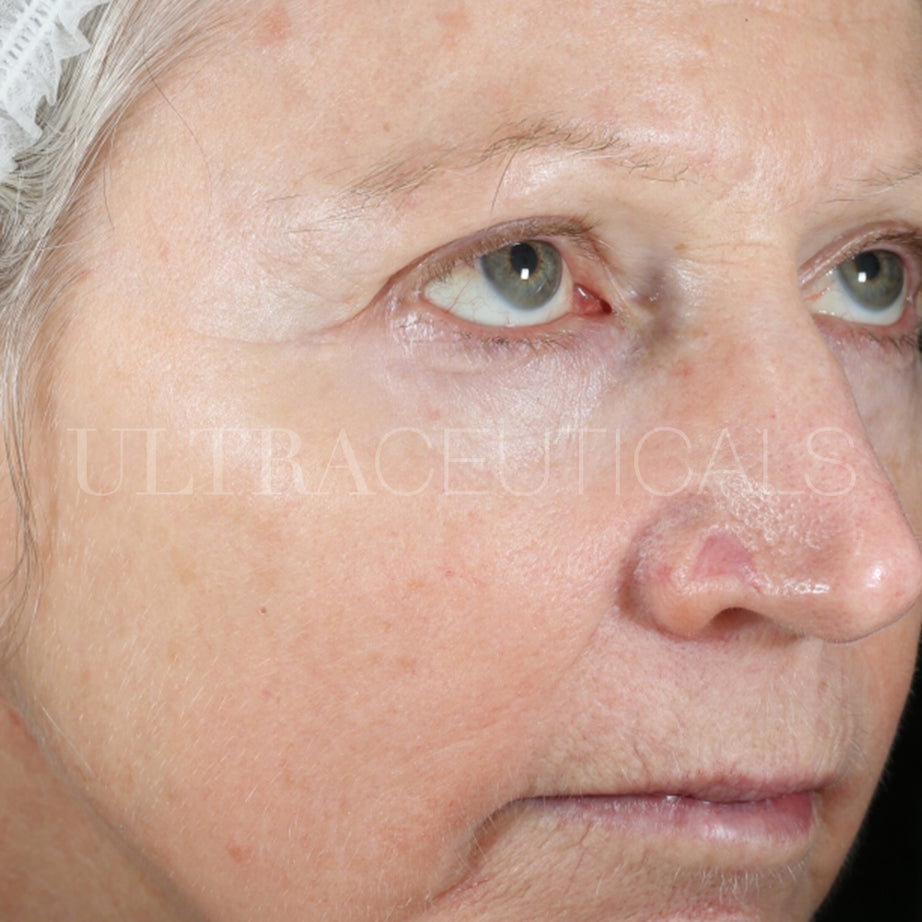 Ultraceuticals real visible results fine lines and wrinkles