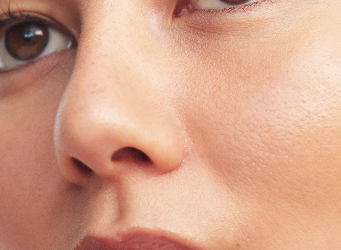 acne and congestion skin