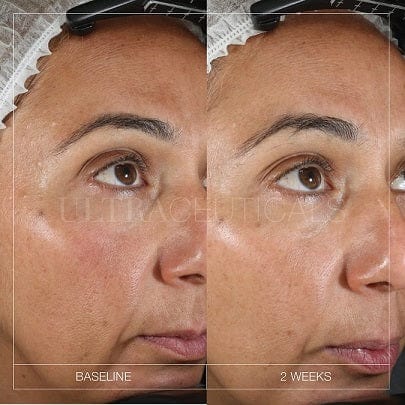 Ultraceuticals AU Face Serum Ultra Brightening Serum Online – Ultraceuticals AU