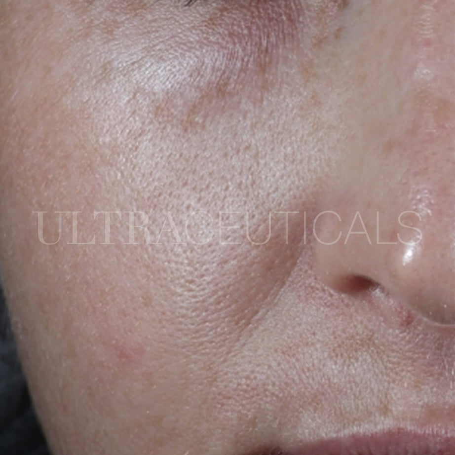Ultraceuticals real visible results texture and pores