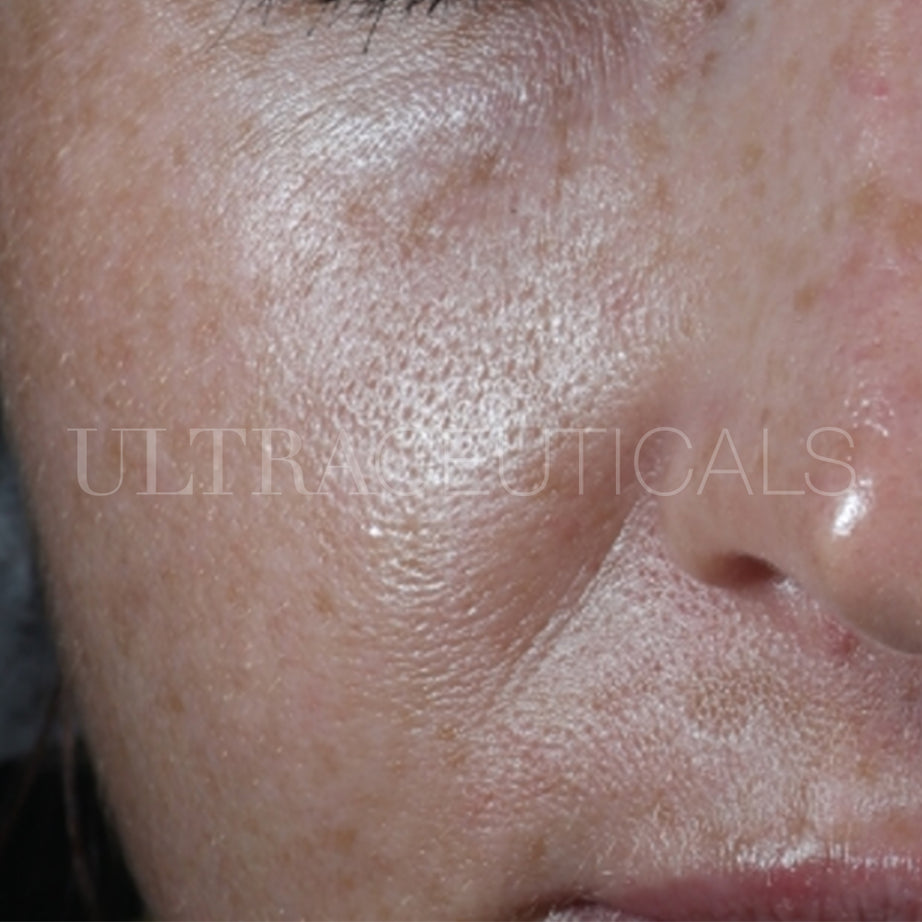 Ultraceuticals real visible results texture and pores