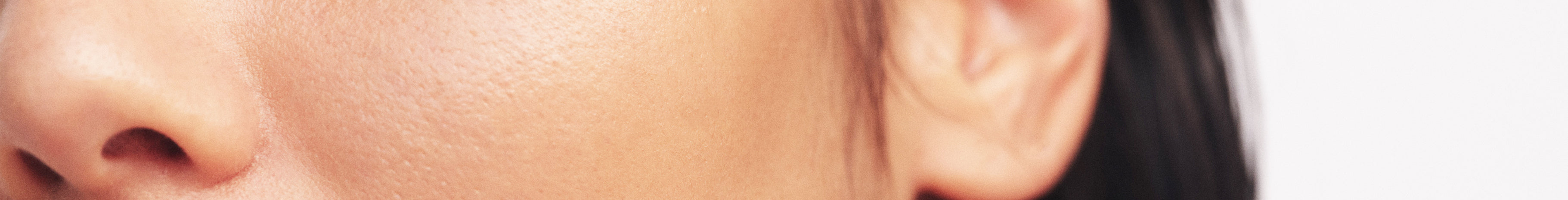 dull skin type