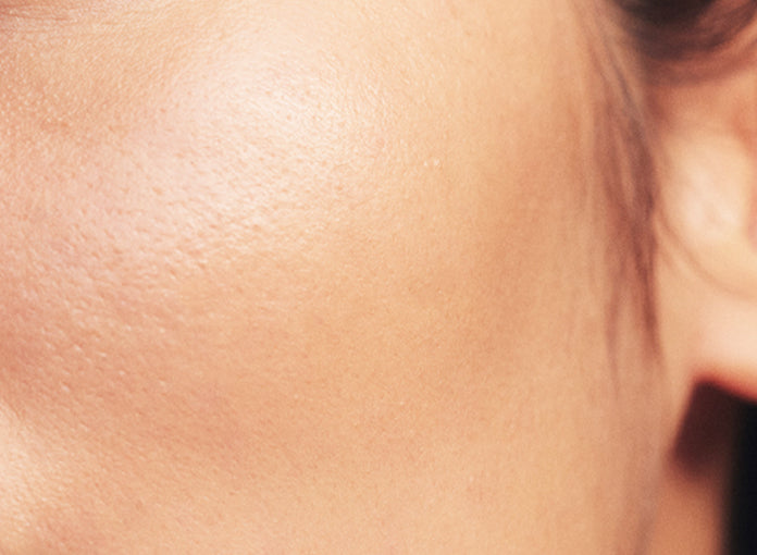 dull skin type