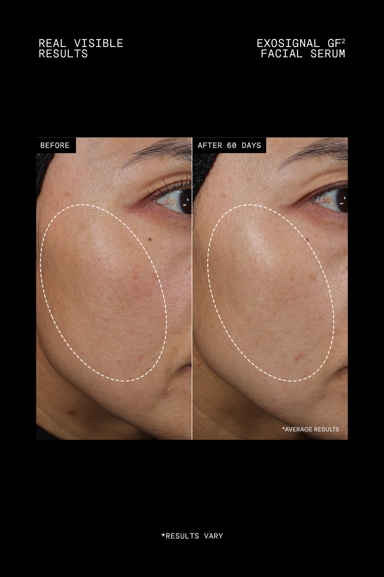 Youth Boost ExoSignal GF² Facial Serum