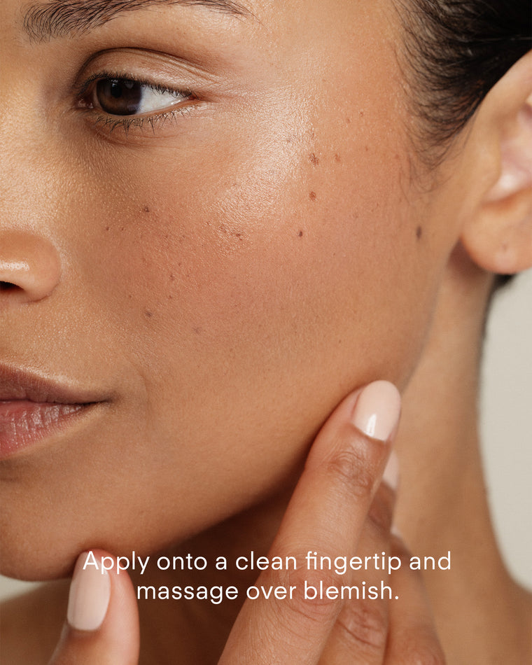 Close-up of a woman’s face with smooth skin and minor blemishes. She touches her cheek. Text: Apply Ultra Clear Spot Complex with a clean fingertip and massage onto blemish for targeted, blemish-fighting care.