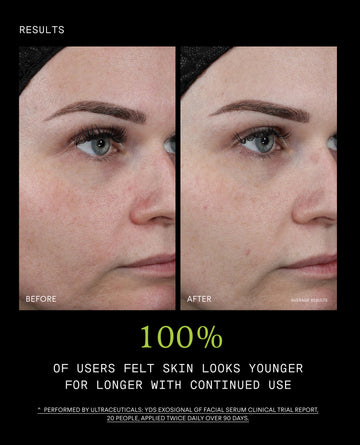 Side-by-side close-up of a woman's face before and after using Youth Boost ExoSignal GF² Facial Serum shows smoother, more even-toned skin; text notes 100% of users felt their skin looked younger with continued use.