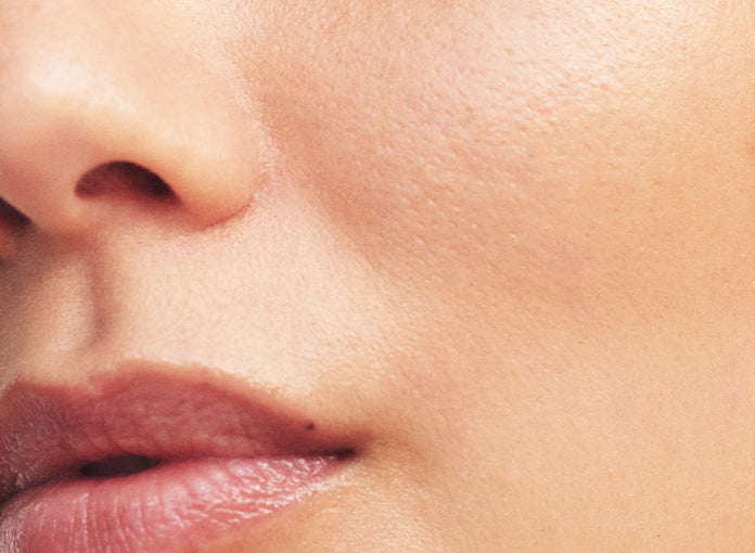 pores and uneven skin texture