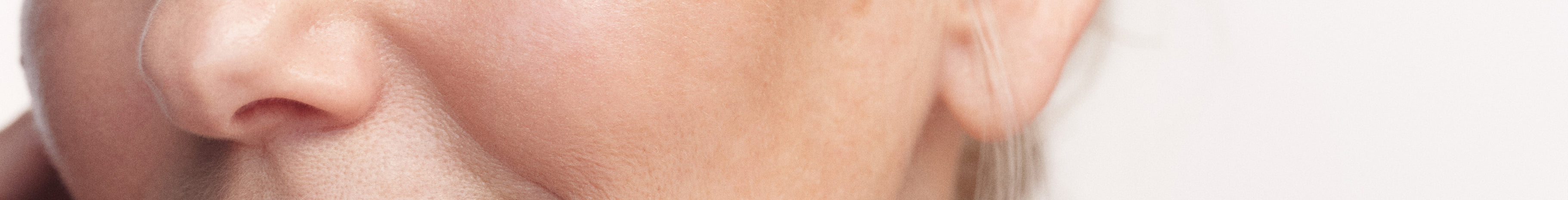 skin sensitivity and redness