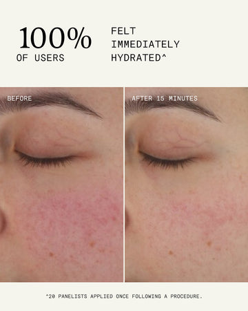 Ultra B² Recovery Cream