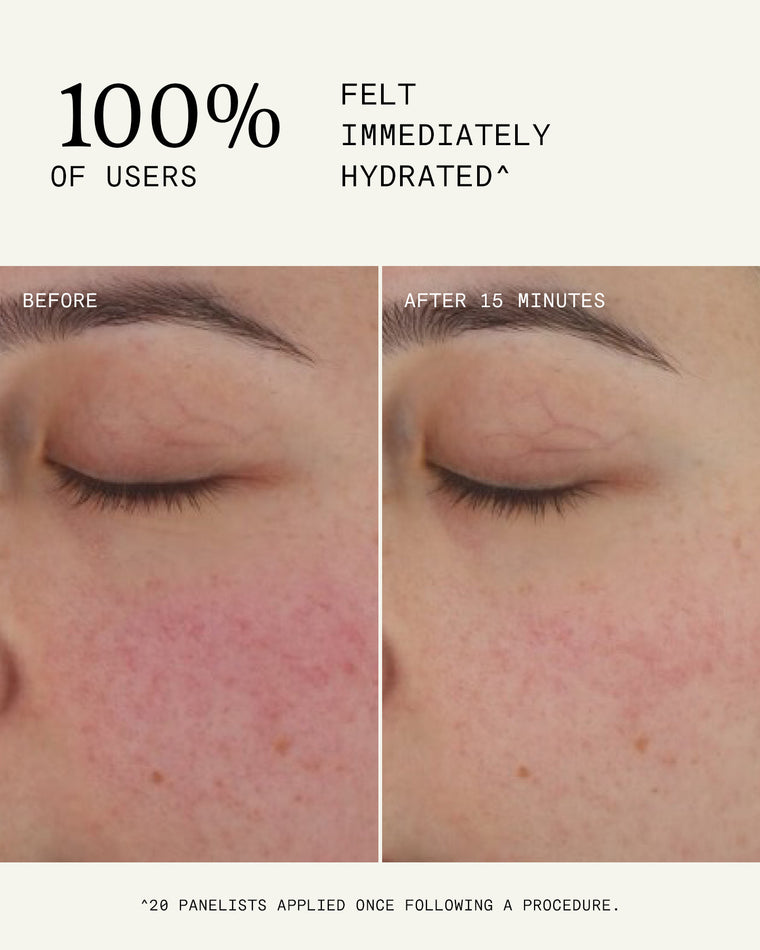 Ultra B² Recovery Cream