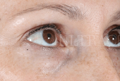 Ultra A Eye Cream
