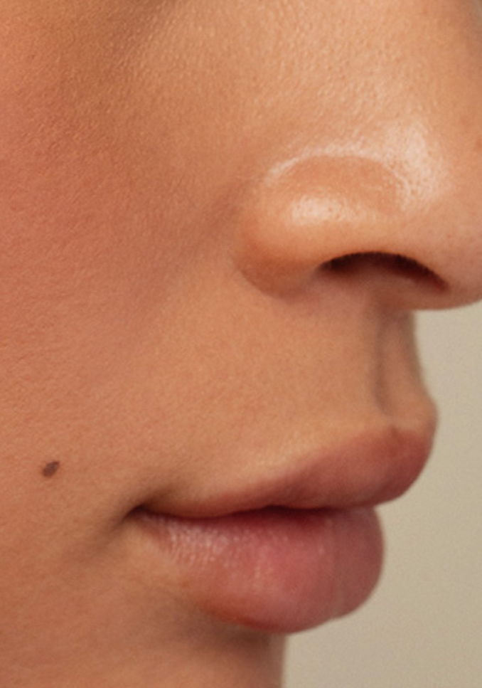 Ultraceuticals best selling moisturisers cleansers and serums