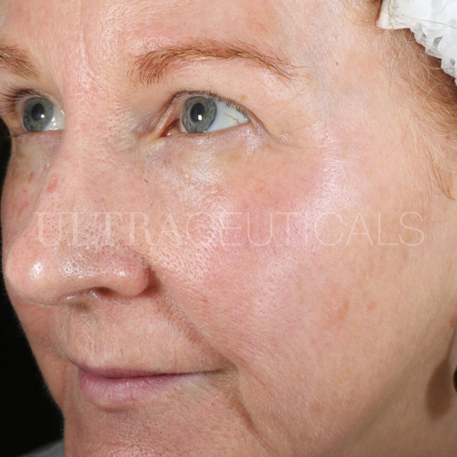 Ultraceuticals real visible results sensitive skin